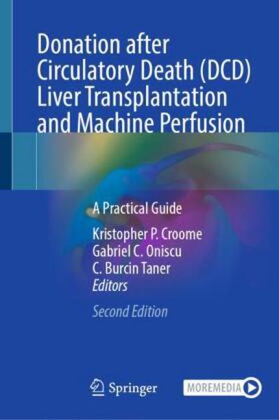 Donation after Circulatory Death (DCD) Liver Transplantation and Machine Perfusion