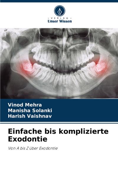 Einfache bis komplizierte Exodontie