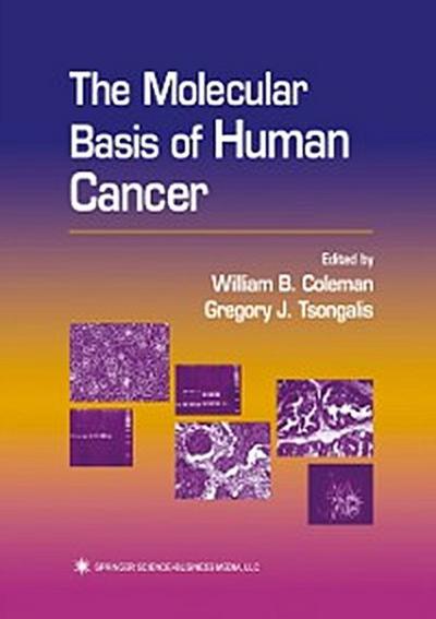 Molecular Basis of Human Cancer