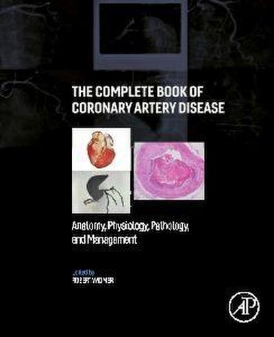 The Complete Book of Coronary Artery Disease