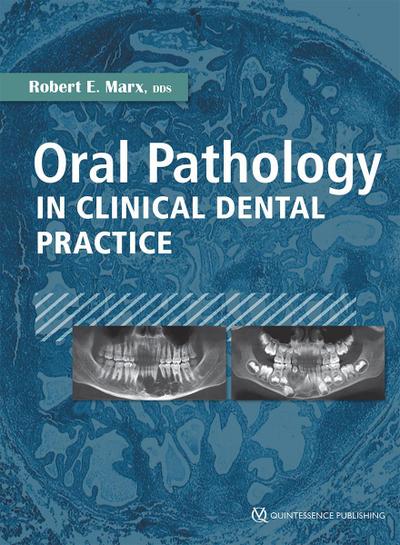 Oral Pathology in Clinical Dental Practice (eBook, EPUB) - Robert E. Marx
