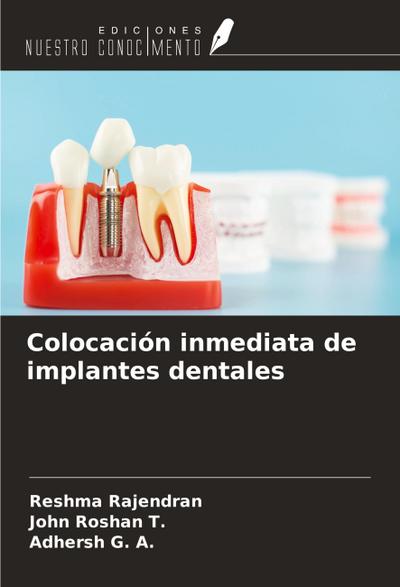Colocación inmediata de implantes dentales