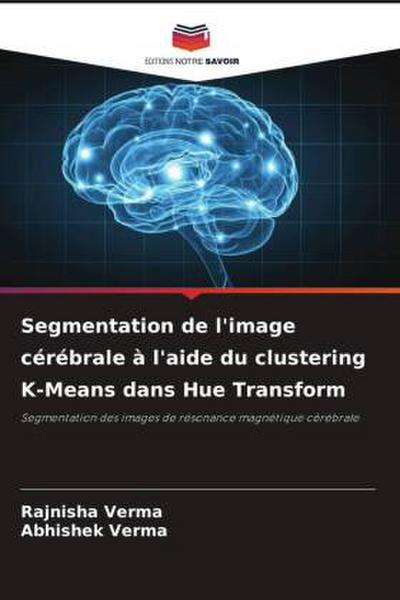 Segmentation de l’image cérébrale à l’aide du clustering K-Means dans Hue Transform