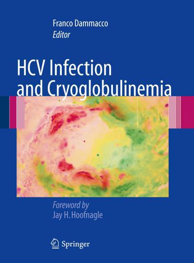 HCV Infection and Cryoglobulinemia