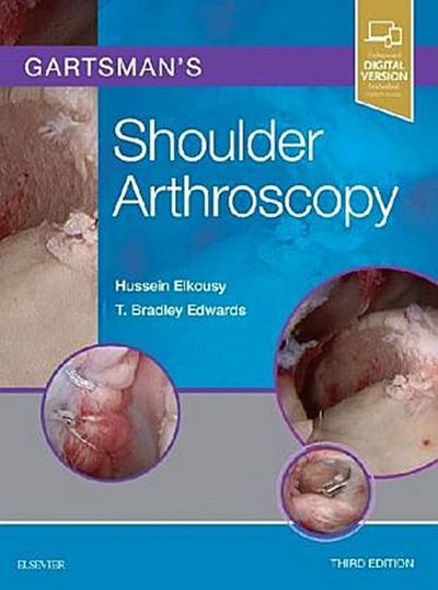 Gartsman’s Shoulder Arthroscopy