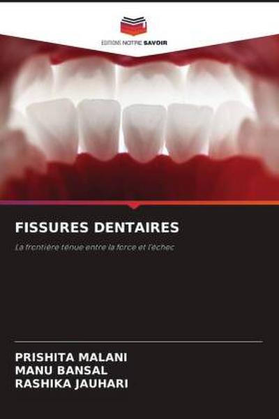 FISSURES DENTAIRES