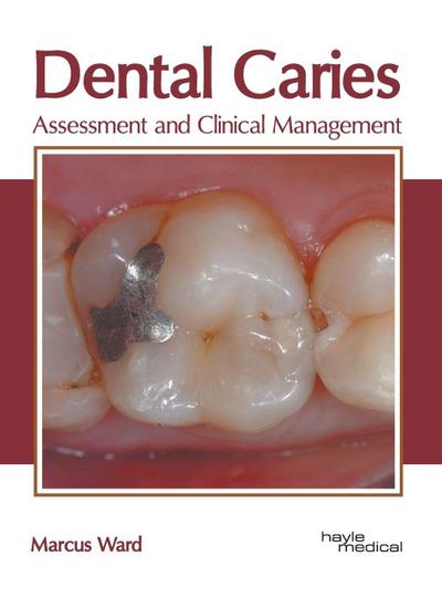 Dental Caries