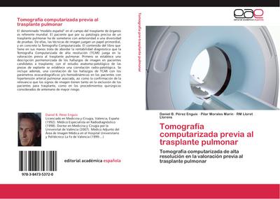 Tomografía computarizada previa al trasplante pulmonar