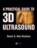 Practical Guide to 3D Ultrasound