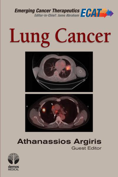 Lung Cancer