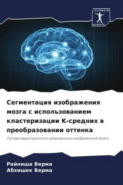 Segmentaciq izobrazheniq mozga s ispol’zowaniem klasterizacii K-srednih w preobrazowanii ottenka