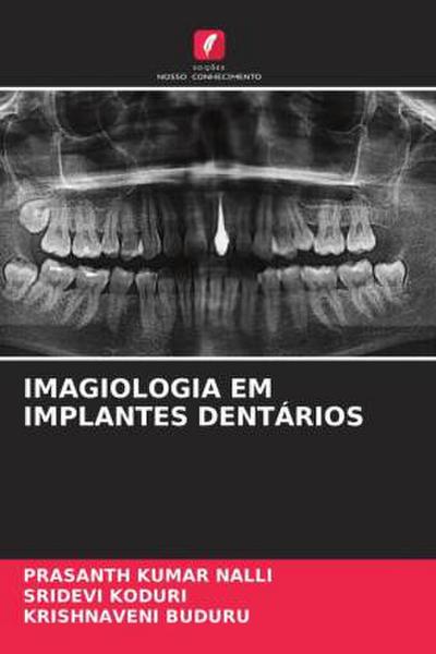 IMAGIOLOGIA EM IMPLANTES DENTÁRIOS