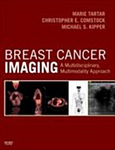 Breast Cancer Imaging E-Book