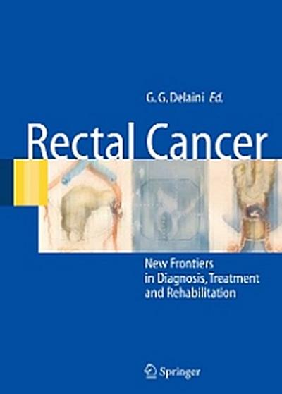 Rectal Cancer