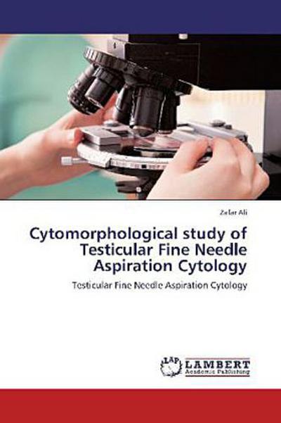 Cytomorphological study of Testicular Fine Needle Aspiration Cytology