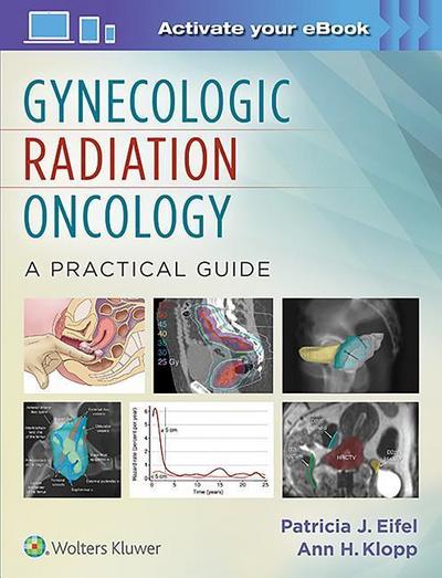 Radiotherapy for Gynecologic Cancers: A Practical Guide