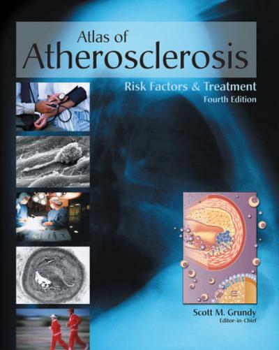 Atlas of Atherosclerosis and Metabolic Syndrome