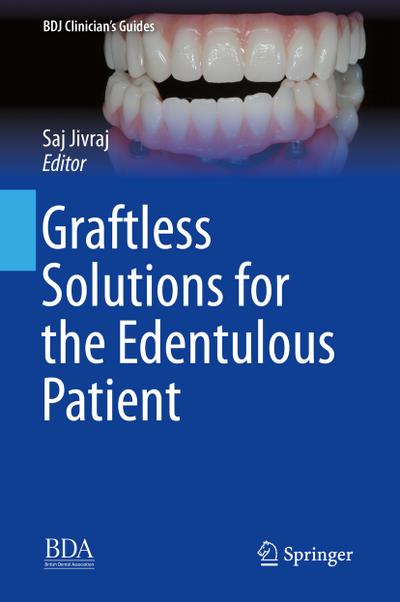 Graftless Solutions for the Edentulous Patient (BDJ Clinician’s Guides)