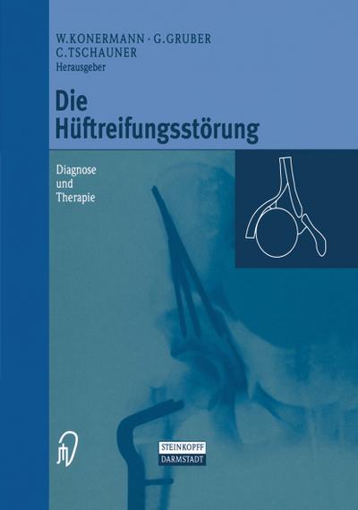 Die Hüftreifungsstörung