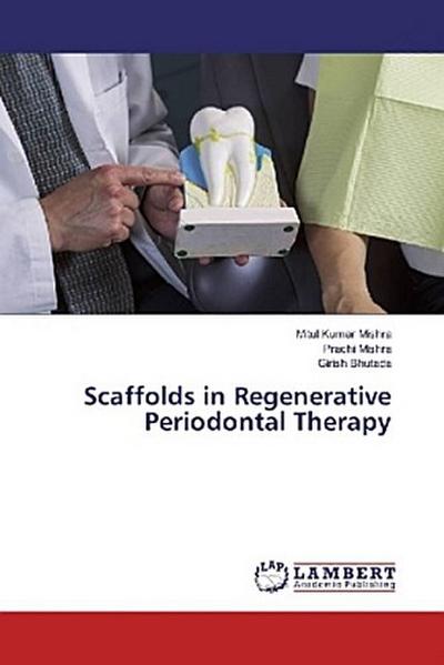 Scaffolds in Regenerative Periodontal Therapy