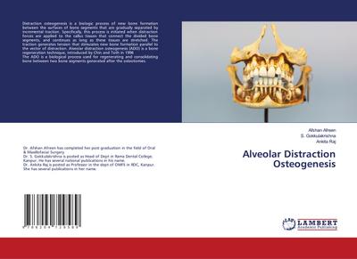 Alveolar Distraction Osteogenesis