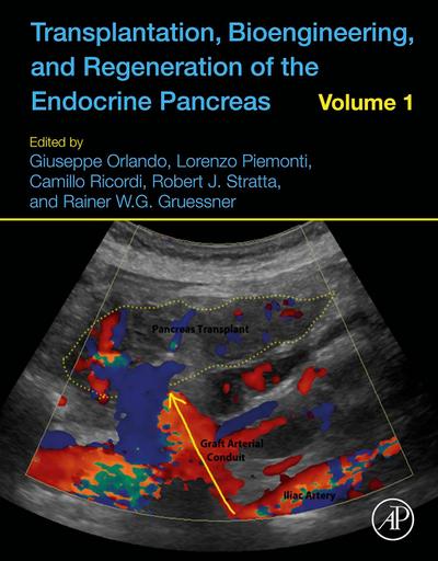 Transplantation, Bioengineering, and Regeneration of the Endocrine Pancreas