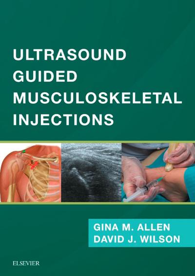 Ultrasound Guided Musculoskeletal Injections E-Book