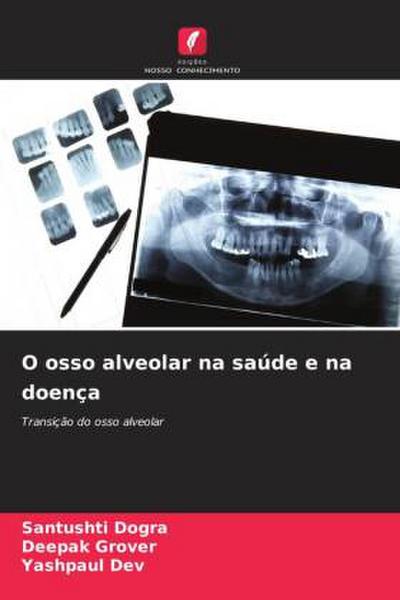 O osso alveolar na saúde e na doença