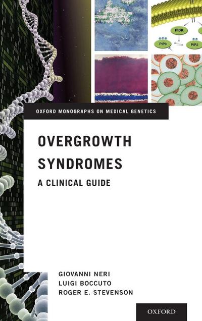 Overgrowth Syndromes