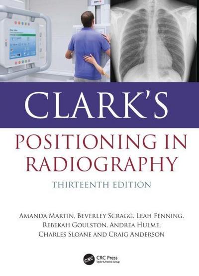 Clark’s Positioning in Radiography