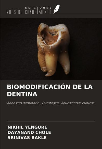 BIOMODIFICACIÓN DE LA DENTINA