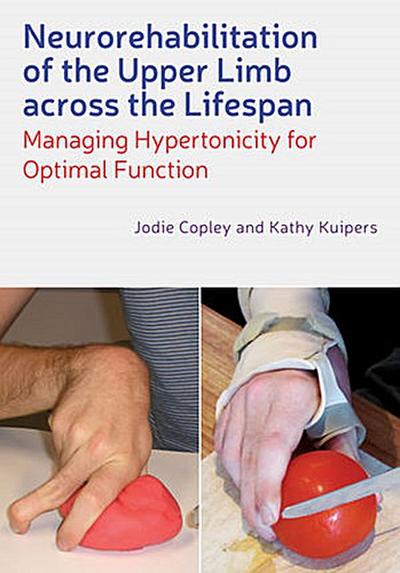 Neurorehabilitation of the Upper Limb Across the Lifespan