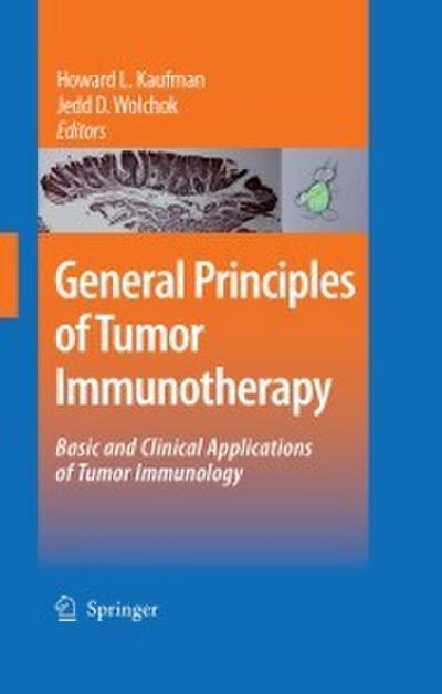 General Principles of Tumor Immunotherapy