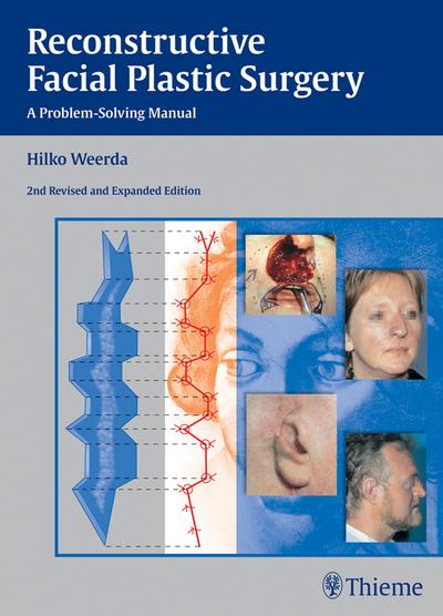 Reconstructive Facial Plastic Surgery
