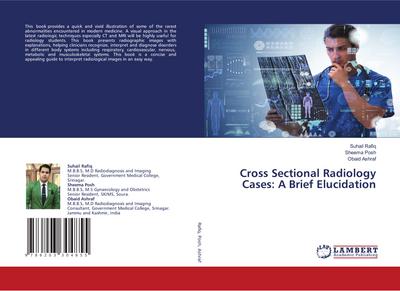 Cross Sectional Radiology Cases: A Brief Elucidation