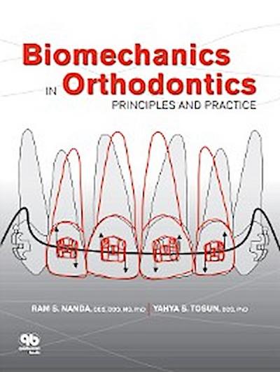 Biomechanics in Orthodontics