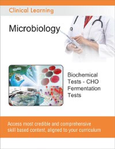 Biochemical Tests - CHO Fermentation Tests