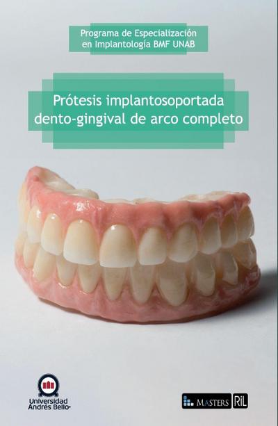 Prótesis implantosoportada dento-gingival de arco completo