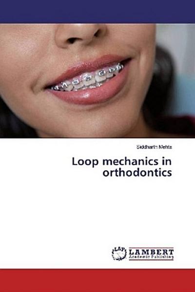 Loop mechanics in orthodontics