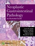 Neoplastic Gastrointestinal Pathology
