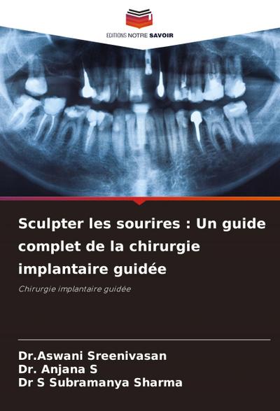 Sculpter les sourires : Un guide complet de la chirurgie implantaire guidée