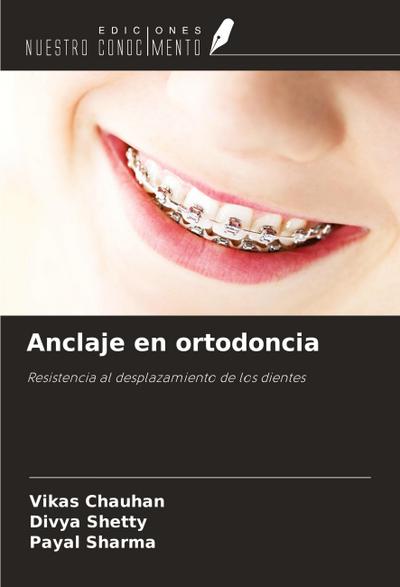 Anclaje en ortodoncia