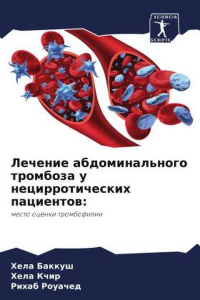 Lechenie abdominal’nogo tromboza u necirroticheskih pacientow: