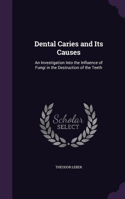 Dental Caries and Its Causes