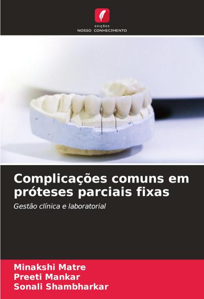 Complicações comuns em próteses parciais fixas