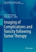 Imaging of Complications and Toxicity following Tu