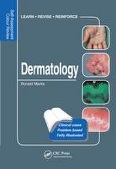 Dermatology
