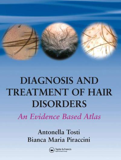 Diagnosis and Treatment of Hair Disorders
