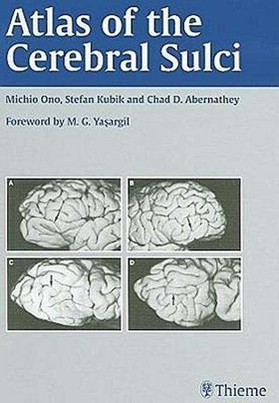Atlas of the Cerebral Sulci