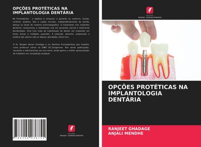 OPÇÕES PROTÉTICAS NA IMPLANTOLOGIA DENTÁRIA